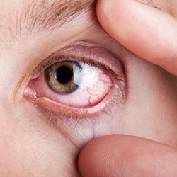 Phase 1/2 Trial Reports Positive Initial Clinical Data of VRDN-001 in Thyroid Eye Disease 
