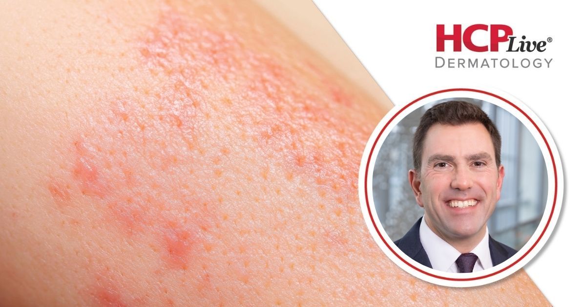 tirzepatide skin Joints, Weight, and Mental Health: Ixekizumab + Tirzepatide for PsA, With  Joseph Merola, MD