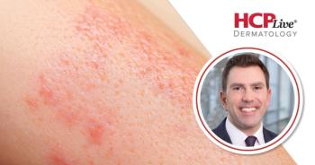 Joints, Weight, and Mental Health: Ixekizumab + Tirzepatide for PsA, With Joseph Merola, MD