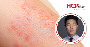 Risankizumab and Treatment Sequencing in Scalp and Genital Psoriasis, With Eingun James Song, MD