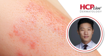 Eingun James Song, MD | Image credit: Frontier Dermatology