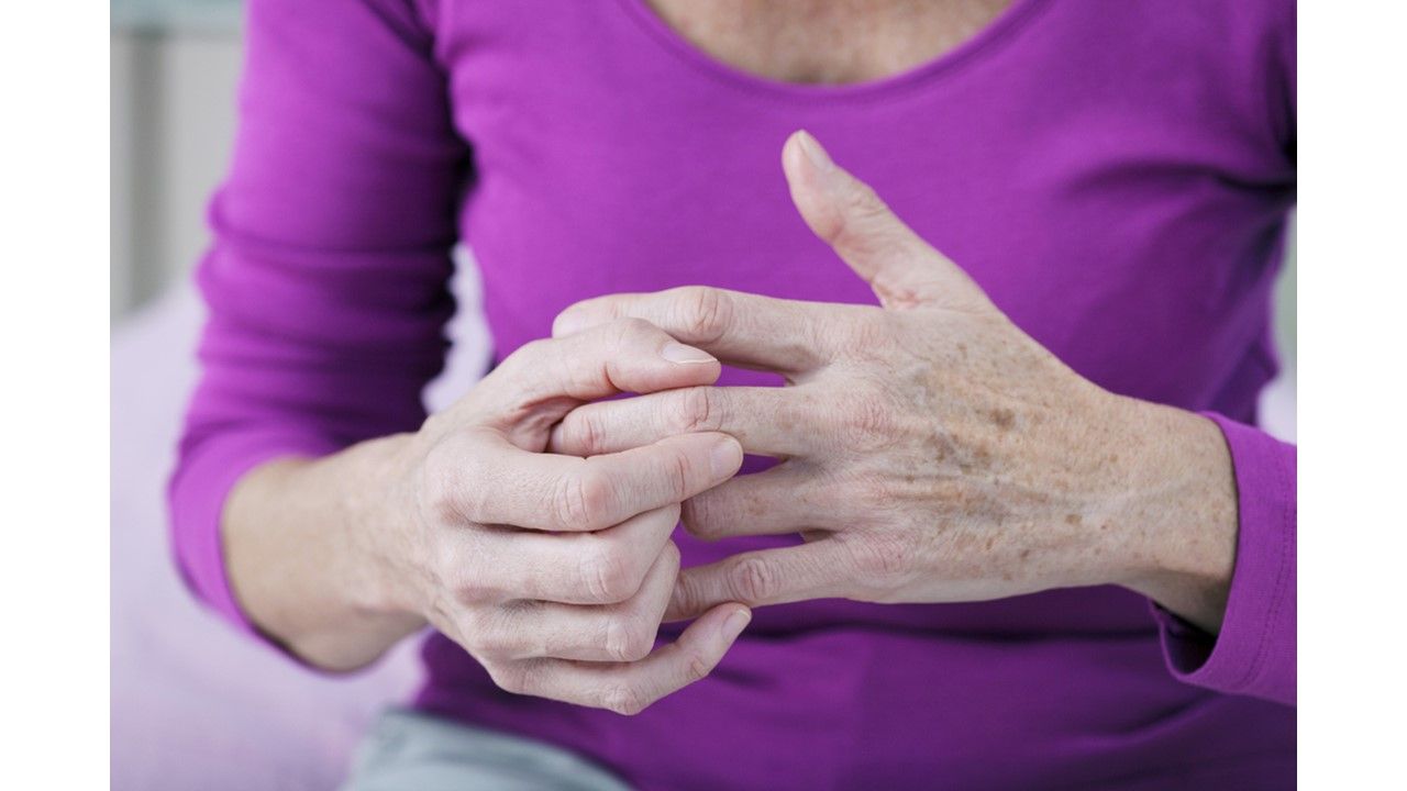 Quiz What is the best state to live in if you have rheumatoid arthritis?