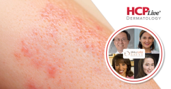Why is the 'Sunscreen Gap' Significant in Dermatology?