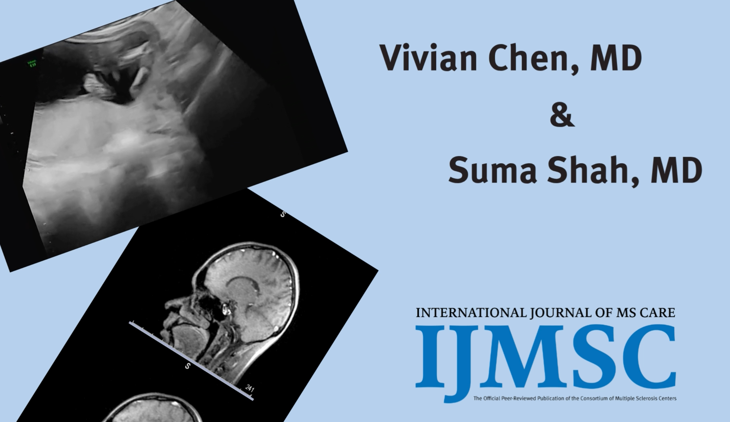 IJMSC Author Spotlight: Vivian Chen, MD, and Suma Shah, MD