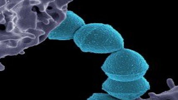 Cytotoxins Contribute to Virulence of Deadly Epidemic Bacterial