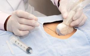 Point of care high-level disinfection for ultrasound probes