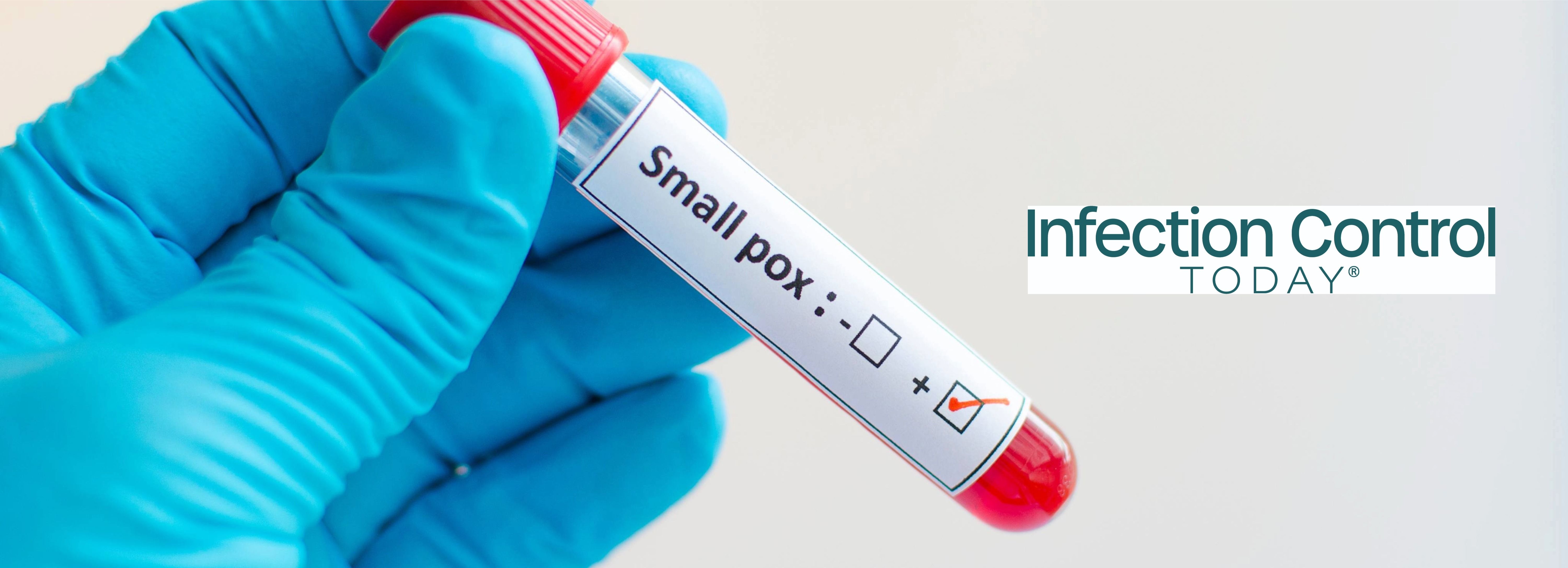 Smallpox positive (Adobe Stock 1492427142 by jarun011)