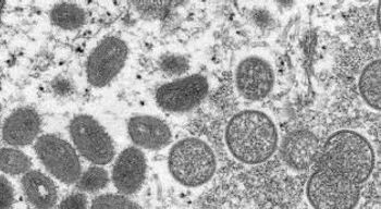 monkeypox seen under a microscope