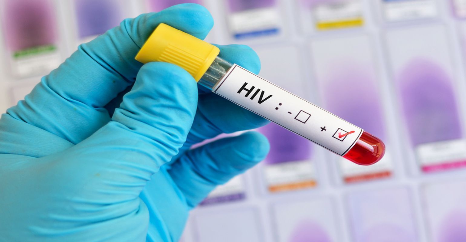 Hiv Infections In U S Could Be Reduced By Up To 67