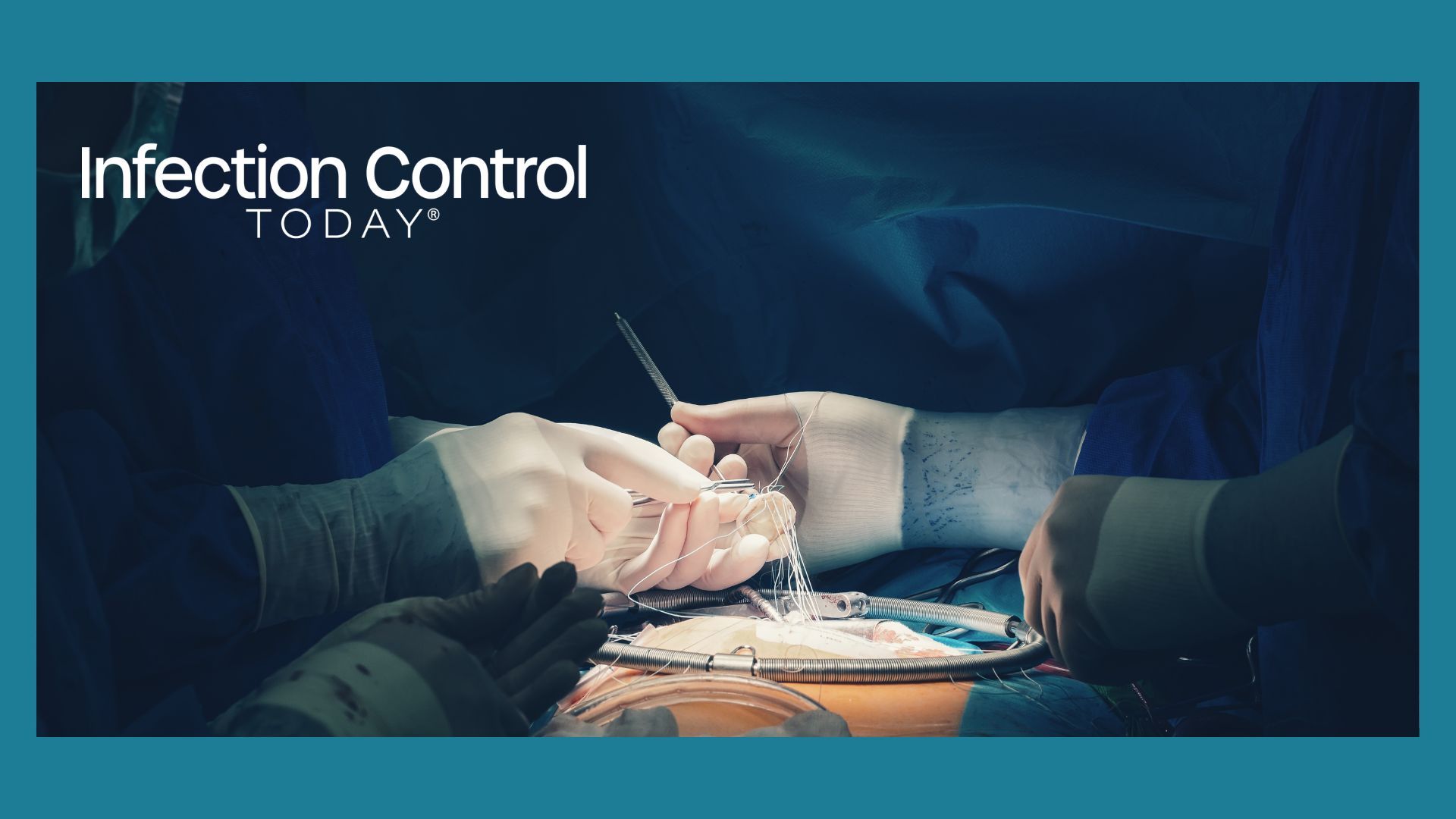 $7.65 Million Verdict in KU Medical Heater-Cooler Infection Case Highlights Ongoing Risks of Mycobacterium chimaera in Cardiac Surgery