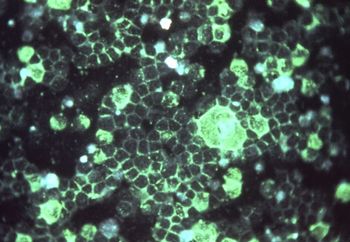 RSV under a microscope