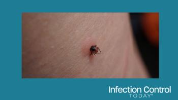 Close-up of a sucking female tick on human irritated skin. The bloated Ixodes ricinus, a dangerous parasite, is biting into the pink, irritated epidermis. Danger of Encephalitis and Lyme disease infection.  (Adobe Stock 449680426 by Sahara Frost)