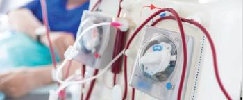 Dialysis machine