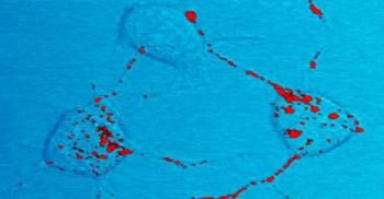 Prion protein, shown in red, can become infectious and cause neurodegenerative d