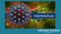 Hantavirus Cell Microscopic 3D Illustration Background (Adobe Stock 2031136855 by Arslan) 