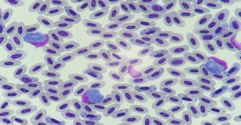 Malaria (Adobe Stock, unknown)