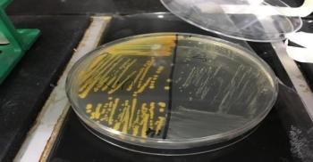 Cigarette smoke accelerates the emergence of antibiotic resistant Small Colony V