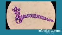 Candida spp, fungi, Close-up micrograph (Adobe Stock 495043092 by MdBabul)