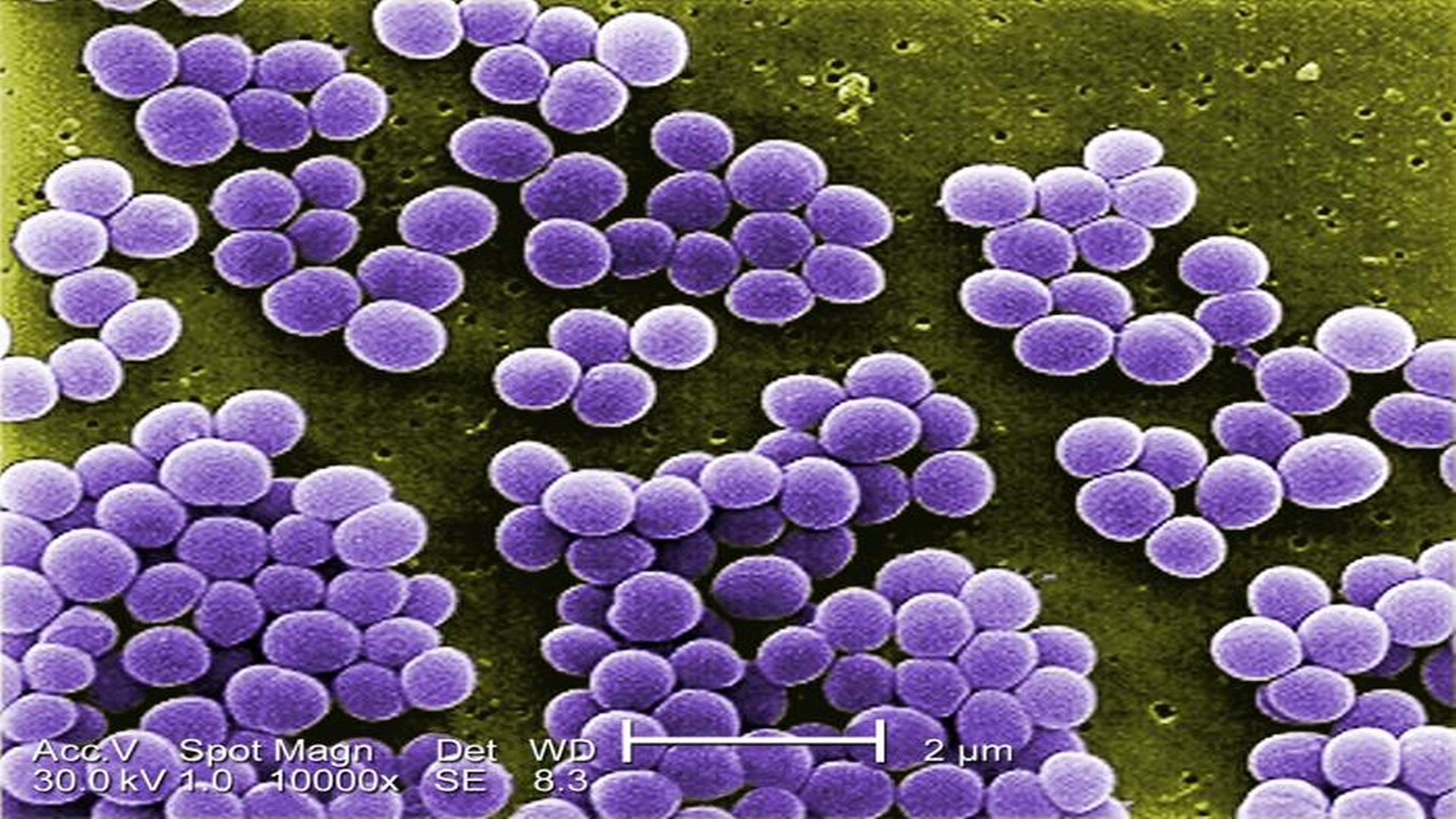 Staphylococcus xylosus. Стафилококк картинки. Золотистый стафилококк фото.