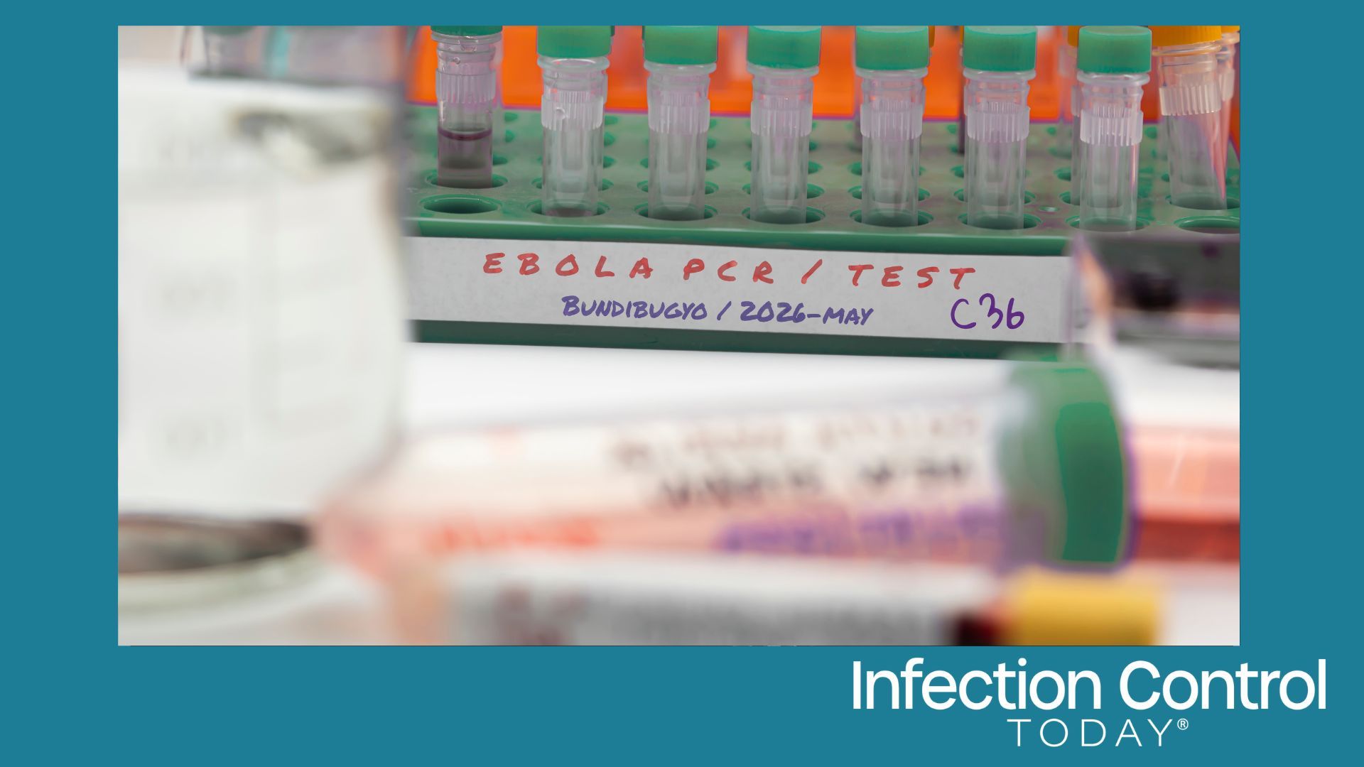 Several vials are being prepared for testing in a laboratory, in a studio reconstruction, in connection with a new Ebola virus in the DRC’s Ituri province, strain Bundibugyo, in the east of the country.  (Adobe Stock 2028671418 by digicomphoto)