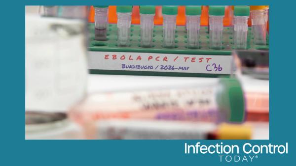 Several vials are being prepared for testing in a laboratory, in a studio reconstruction, in connection with a new Ebola virus in the DRC’s Ituri province, strain Bundibugyo, in the east of the country.  (Adobe Stock 2028671418 by digicomphoto)