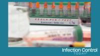 Several vials are being prepared for testing in a laboratory, in a studio reconstruction, in connection with a new Ebola virus in the DRC’s Ituri province, strain Bundibugyo, in the east of the country. (Adobe Stock 2028671418 by digicomphoto)