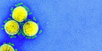 6f6711a33df82e64fa2e40bb9198b5b407e7aa53