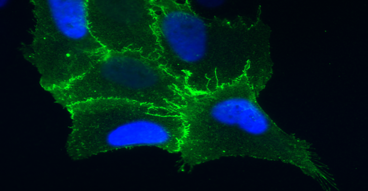 Study Identifies How Hantaviruses Infect Lung Cells | Infection Control ...