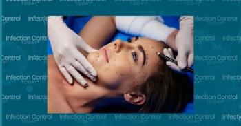 Woman lying down with lines written on her face prior to plastic surgery.  (Adobe Stock 87953671 by Photo-maxx)