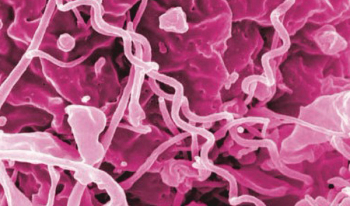 microscopic image of bacteria