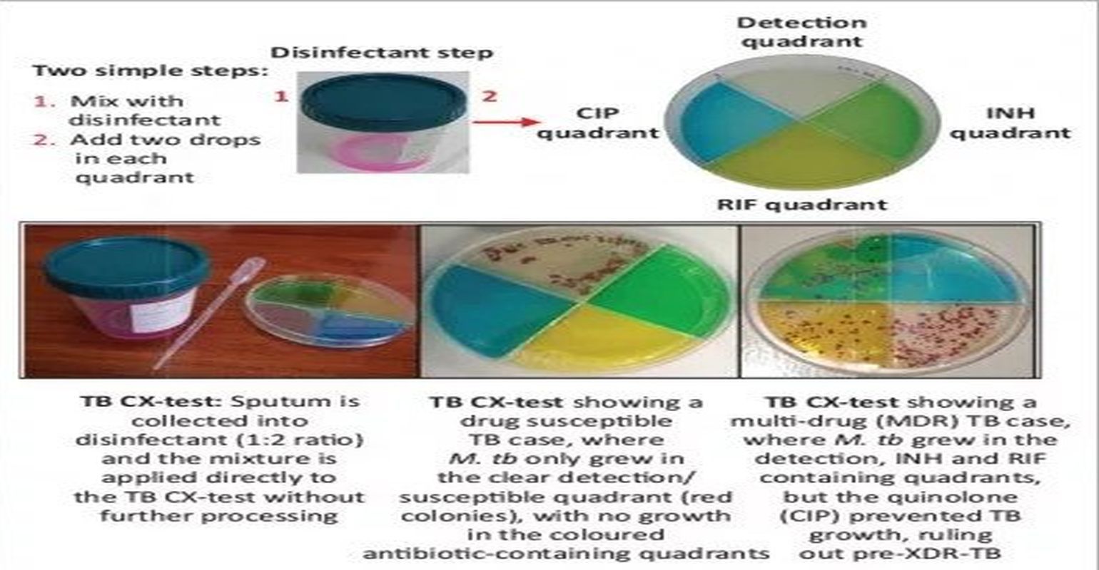 Tb Testing Simulation Lab Inexpensive TB Test Holds Promise for Low-Income Countries