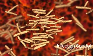 Mycobacterium avium-intracellulare, MAI, non-tuberculous mycrobacteria which cause opportunistic infections in HIV-infected patients, 3D illustration (Adobe Stock 166086779 by Dr_Microbe)