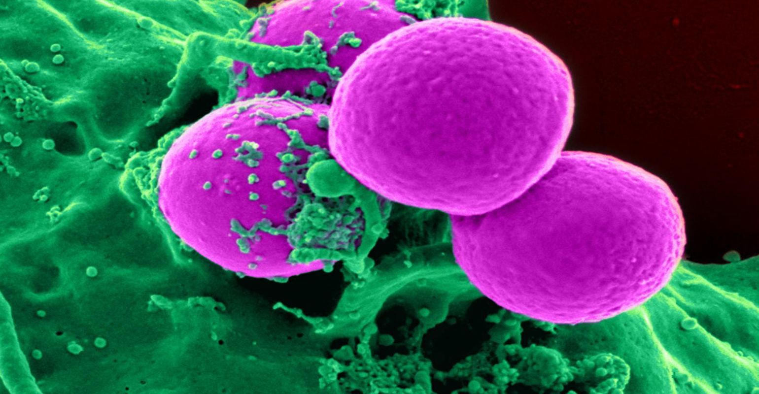 Researchers Discover How Antibiotic-Resistant Bacteria Construct Their ...