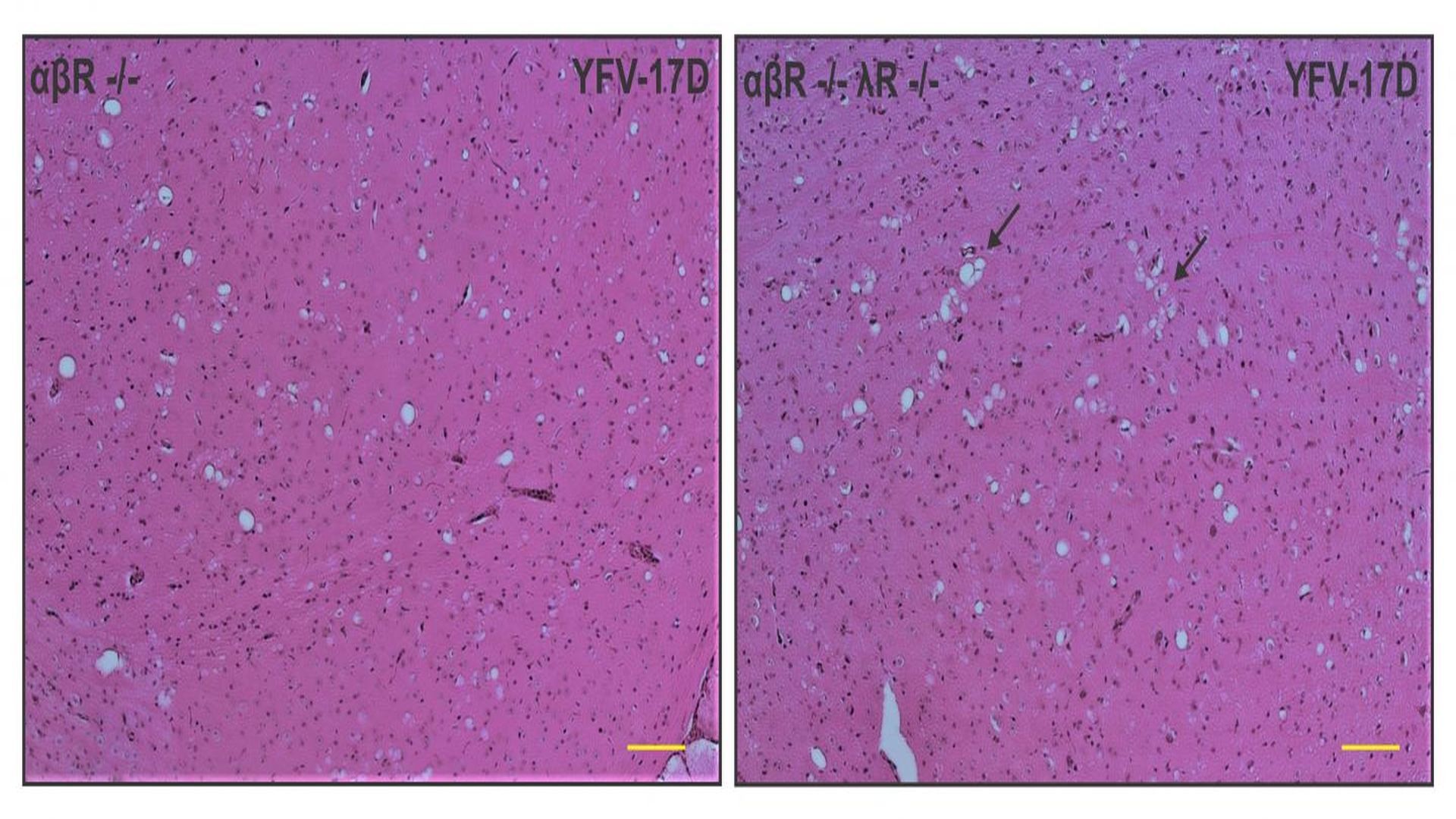 An Immune Signaling Pathway for Control of Yellow Fever Virus infection