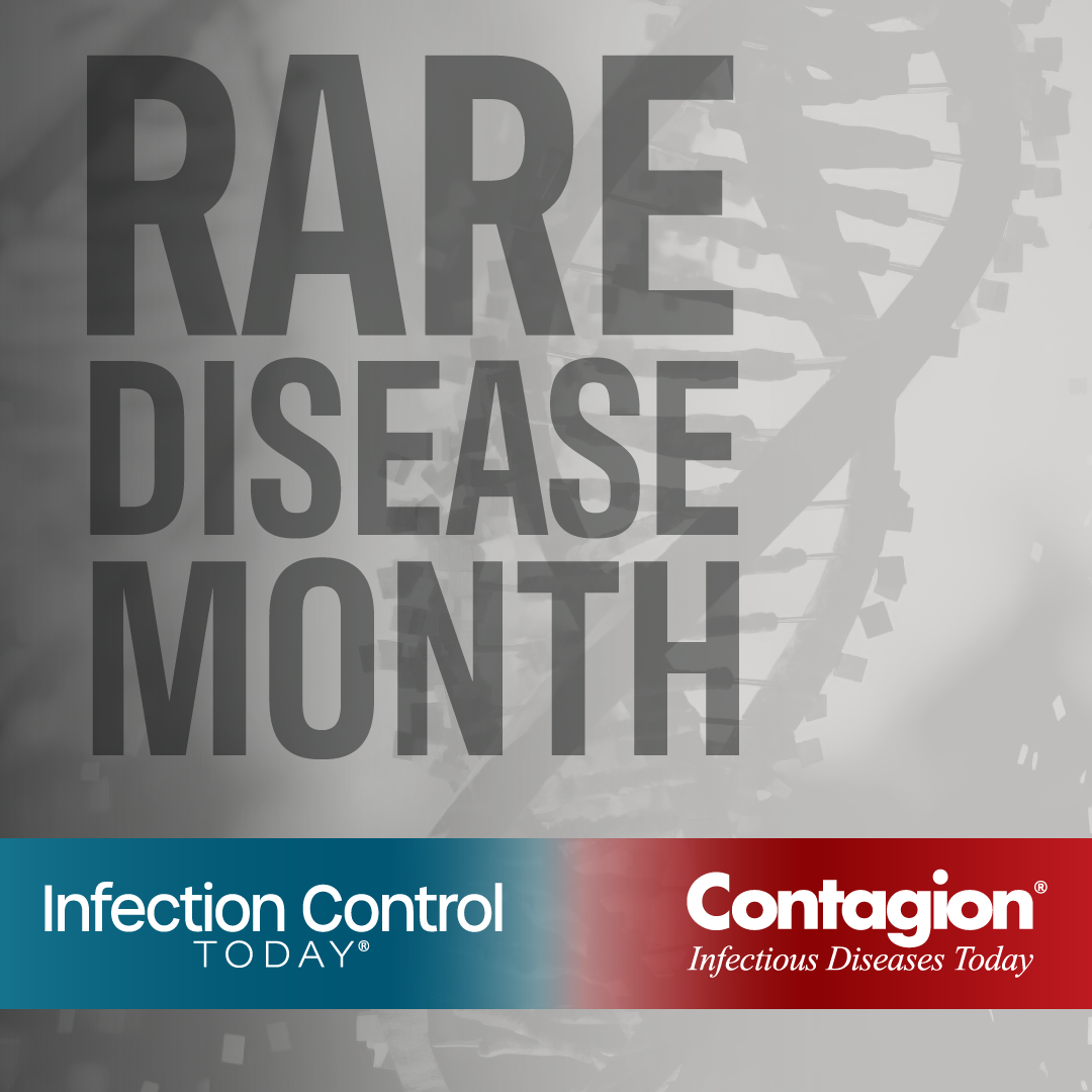 What You Need to Know About 3 Rare Infectious Eye Diseases What You Need to Know About 3 Rare Infectious Eye Diseases