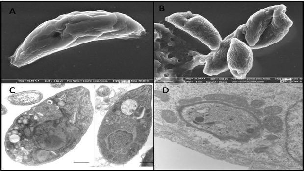 a parasitic infection caused by Toxoplasma gondii