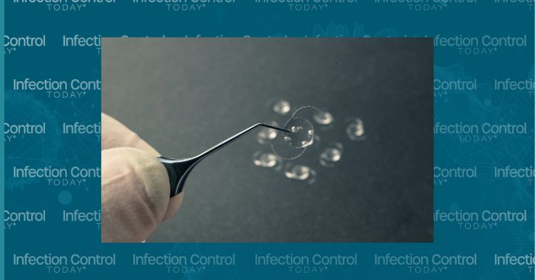 An eye instrument holding an intraocular lens for cataract surgery. How to clean and sterilize it appropriately?   (Adobe Stock 417326809By Mohammed)