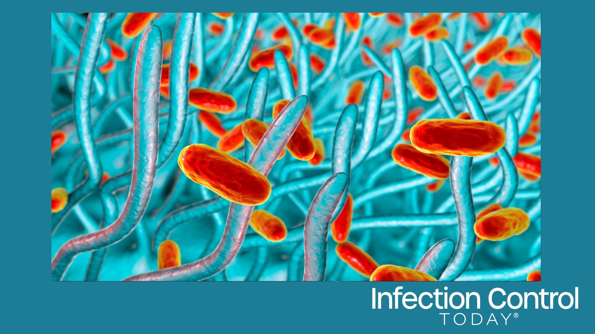 Whooping cough bacteria, Bordetella pertussis in the respiratory tract, 3D illustration showing cilia of respiratory epithelium and bacteria (Adobe Stock 309780846 by Dr_Microbe)
