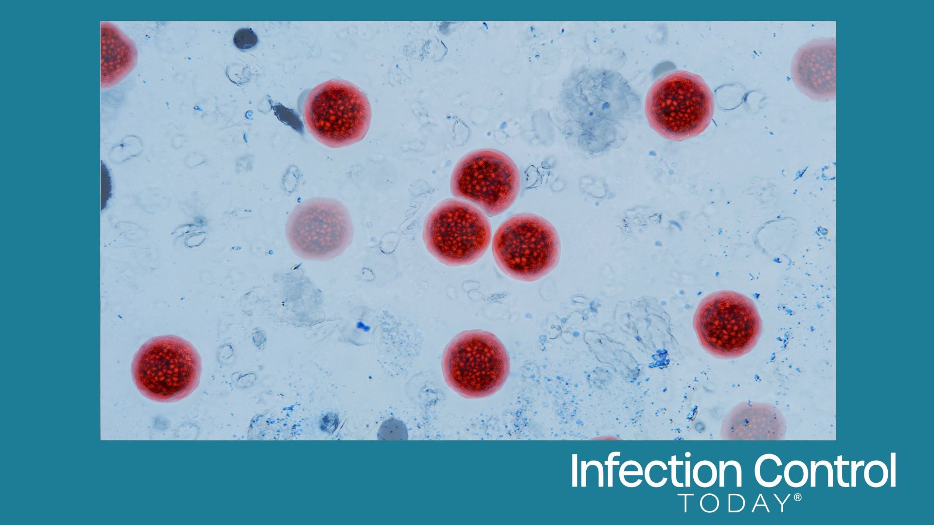Microscopic view of Cyclospora cayetanensis oocysts under magnification, stained bright red. cyclosporiasis outbreak, foodborne parasites, intestinal infections. water pollution. (Adobe Stock 2122448953 by alones)
