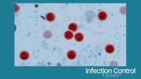 Microscopic view of Cyclospora cayetanensis oocysts under magnification, stained bright red. cyclosporiasis outbreak, foodborne parasites, intestinal infections. water pollution.  (Adobe Stock 2122448953 by alones) 