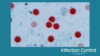 Microscopic view of Cyclospora cayetanensis oocysts under magnification, stained bright red. cyclosporiasis outbreak, foodborne parasites, intestinal infections. water pollution.  (Adobe Stock 2122448953 by alones) 