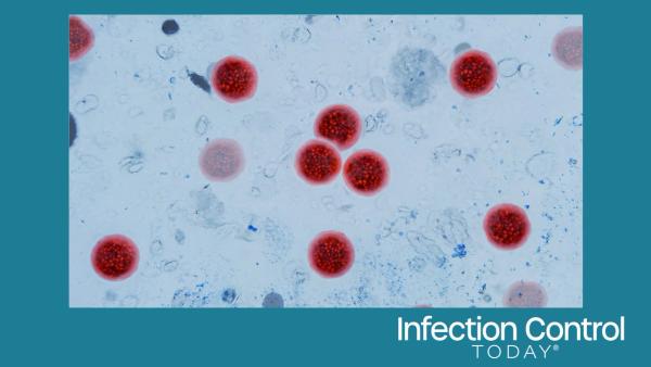 Microscopic view of Cyclospora cayetanensis oocysts under magnification, stained bright red. cyclosporiasis outbreak, foodborne parasites, intestinal infections. water pollution.  (Adobe Stock 2122448953 by alones) 