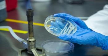 gloved hands holding a slide which holds bacteria