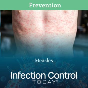 Measles  (Adobe Stock) 