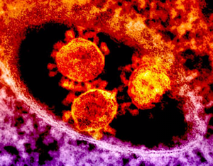 Evidence Continues to Link ACE Inhibitors to Severe COVID-19 Symptoms