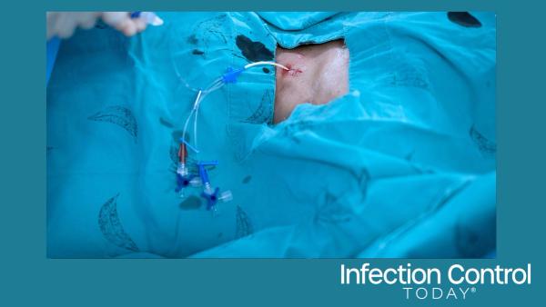 An anesthetist setting central venous catheter to patient before open heart surgery (Adobe Stock 437277275 by Pijitra)