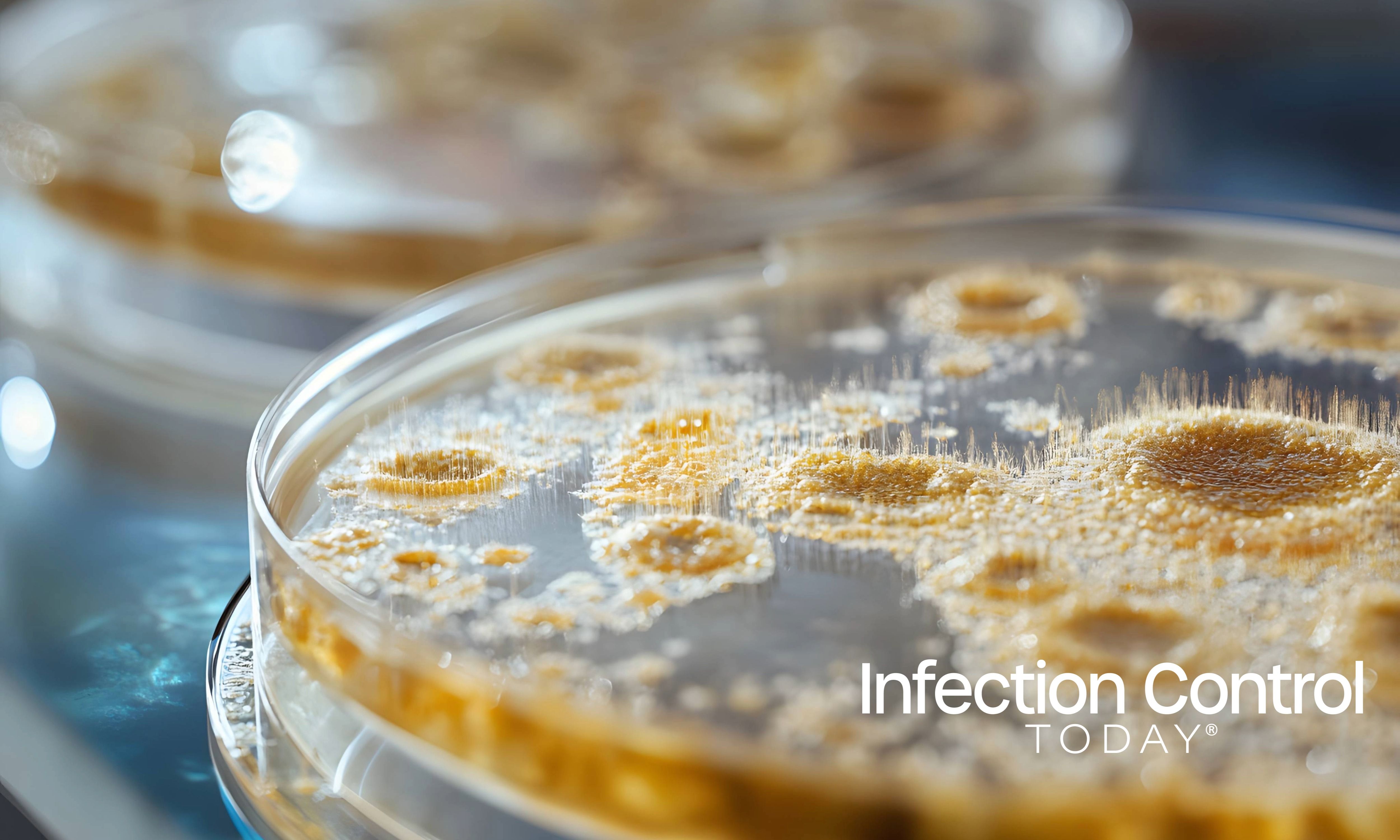 Close-up of petri dishes with fungal cultures for scientific microbiology and research. (Adobe Stock 1467220225 by Tithi)
