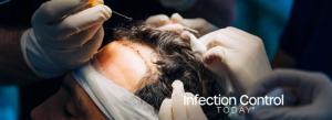 Hair Transplant Operation Process with Surgeon. (Adobe Stock 598067700 by Ivan)