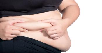Obesity  (Adobe Stock, unknown)