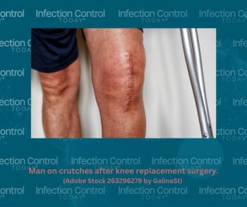 Man on crutches after knee replacement surgery.  (Adobe Stock 263296279 by GalinaSt.) 